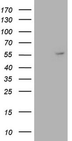 ANGPT1 Monoclonal Antibody (OTI8C5), TrueMAB , OriGene 30 &mu;L; Unconjugated:Anticuerpos