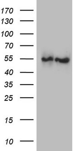 ANGPTL1 Monoclonal Antibody (OTI9E5), TrueMAB , OriGene 100 &mu;L; Unconjugated:Antibodies,