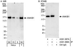 ANKIB1 Rabbit anti-Human, Polyclonal, Bethyl Laboratories 100 &mu;L; Unconjugated:Antibodies,