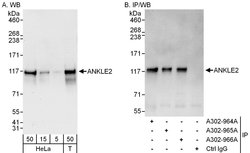 ANKLE2 Rabbit anti-Human, Polyclonal, Bethyl Laboratories 100 &mu;L; Unconjugated:Antibodies,