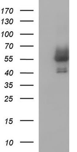 ANKMY2 Monoclonal Antibody (OTI2C3), TrueMAB , OriGene:Antibodies:Primary