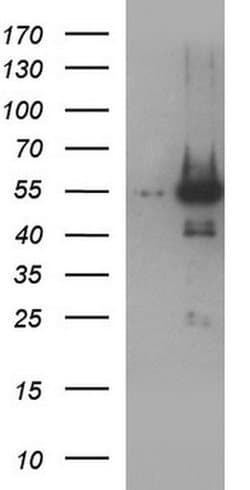 ANKMY2 Monoclonal Antibody (OTI1C12), TrueMAB , OriGene 100 &mu;L | Buy Online | Origene Technologies | Fisher Scientific