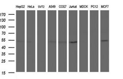 ANKMY2 Monoclonal Antibody (OTI1C12), TrueMAB , OriGene 100 &mu;L | Buy Online | Origene Technologies | Fisher Scientific