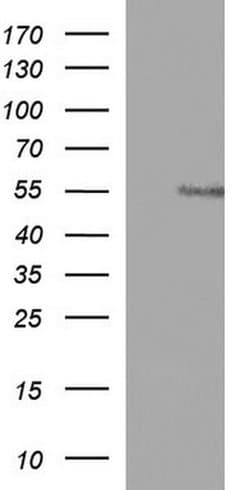 ANKMY2 Monoclonal Antibody (OTI1D8), TrueMAB , OriGene 100 &mu;L; Unconjugated:Antibodies,