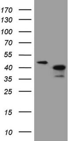 ANKRA2 Monoclonal Antibody (OTI8A9), TrueMAB , OriGene:Antibodies:Primary