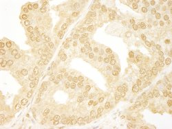 ANKRD17 Polyclonal Antibody, Bethyl Laboratories 10 &mu;L; Unconjugated:Antibodies,