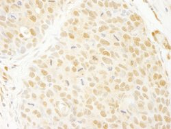 ANKRD17 Polyclonal Antibody, Bethyl Laboratories 10 &mu;L; Unconjugated:Antibodies,