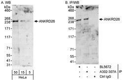 ANKRD26 Rabbit anti-Human, Polyclonal, Bethyl Laboratories 100 &mu;L; Unconjugated:Antibodies,