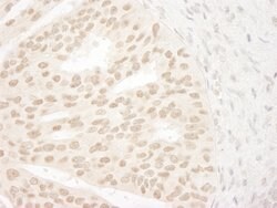 ANKRD28/PITK Rabbit anti-Human, Polyclonal, Bethyl Laboratories 100 &mu;L;