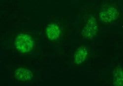 ANKRD49 Monoclonal Antibody (OTI3E4), TrueMAB , OriGene 100 &mu;L; Unconjugated:Antibodies,