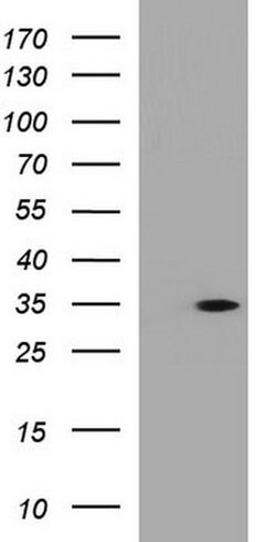ANKRD49 Monoclonal Antibody (OTI3E4), TrueMAB , OriGene:Antibodies:Primary