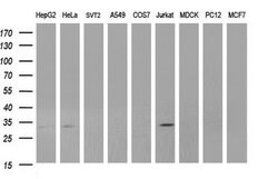 ANKRD49 Monoclonal Antibody (OTI3E4), TrueMAB , OriGene:Antibodies:Primary