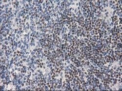ANKRD53 Monoclonal Antibody (OTI1E1), TrueMAB , OriGene 100 &mu;L; Unconjugated:Antibodies,
