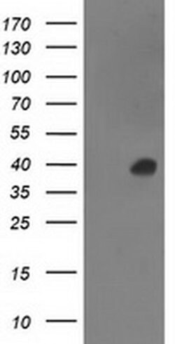 ANKRD53 Monoclonal Antibody (OTI1B8), TrueMAB , OriGene 30 &mu;L; Unconjugated:Antibodies,