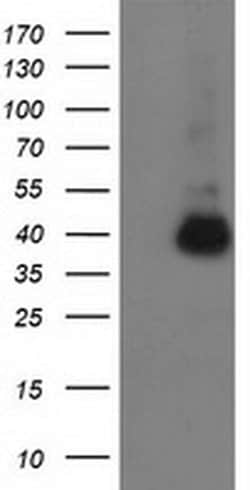 ANKRD53 Monoclonal Antibody (OTI2F3), TrueMAB , OriGene 30 &mu;L; Unconjugated:Antibodies,