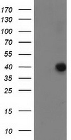 ANKRD53 Monoclonal Antibody (OTI1E1), TrueMAB , OriGene 100 &mu;L; Unconjugated:Antibodies,