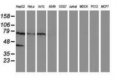 ANKRD53 Monoclonal Antibody (OTI1E1), TrueMAB , OriGene 100 &mu;L; Unconjugated:Antibodies,