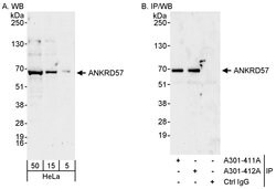 ANKRD57 Rabbit anti-Human, Polyclonal, Bethyl Laboratories 100 &mu;L; Unconjugated:Antibodies,