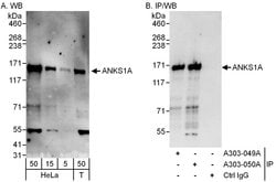 ANKS1A Rabbit anti-Human, Polyclonal, Bethyl Laboratories 100 &mu;L; Unconjugated:Antibodies,