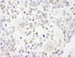 ANKS3 Polyclonal Antibody, Bethyl Laboratories 10 &mu;L; Unconjugated:Antibodies,