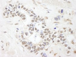 ANKS3 Polyclonal Antibody, Bethyl Laboratories 10 &mu;L; Unconjugated:Antibodies,