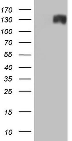 ANO1 Monoclonal Antibody (OTI5H7), TrueMAB , OriGene 100 &mu;L; Unconjugated:Antibodies,