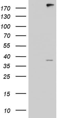 ANO1 Mouse anti-Human, Clone: OTI5H2, lyophilized, TrueMAB 100 &mu;g; Unconjugated:Antibodies,