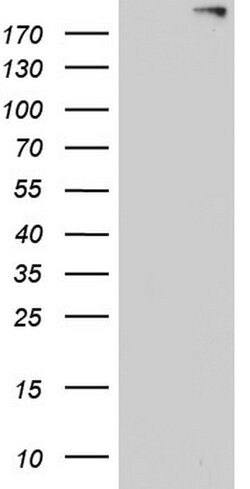 ANO1 Mouse anti-Human, Clone: OTI1E6, lyophilized, TrueMAB 100 &mu;g; Unconjugated:Antibodies,