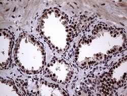 ANP32C Monoclonal Antibody (OTI10A10), TrueMAB , OriGene 100 &mu;L; Unconjugated:Antibodies,