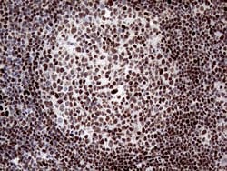 ANP32C Monoclonal Antibody (OTI10A10), TrueMAB , OriGene 100 &mu;L; Unconjugated:Antibodies,