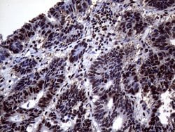 ANP32C Monoclonal Antibody (OTI10A10), TrueMAB , OriGene 100 &mu;L; Unconjugated:Antibodies,