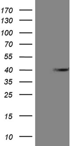 ANP32C Monoclonal Antibody (OTI10A10), TrueMAB , OriGene 100 &mu;L; Unconjugated:Antibodies,