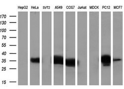 ANXA1 Mouse anti-Human, Clone: OTI3A8, liquid, TrueMAB 100 &mu;L; Unconjugated:Antibodies,