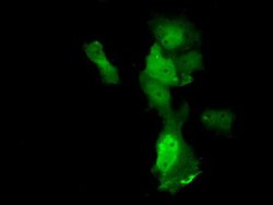 ANXA11 Mouse anti-Human, Clone: OTI1C6, lyophilized, TrueMAB 100 &mu;g;