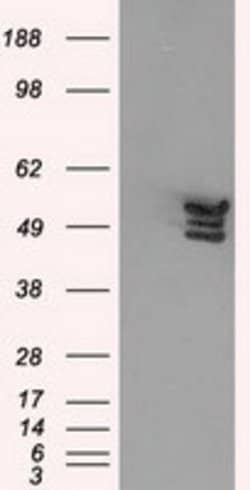 ANXA11 Mouse anti-Human, Clone: OTI1C6, lyophilized, TrueMAB 100 &mu;g;