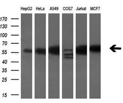 ANXA11 Mouse anti-Human, Clone: OTI1C6, lyophilized, TrueMAB 100 &mu;g;
