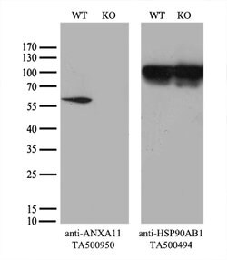 ANXA11 Mouse anti-Human, Clone: OTI1C6, lyophilized, TrueMAB 100 &mu;g;