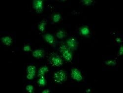 ANXA3 Monoclonal Antibody (OTI2F3), TrueMAB , OriGene 100 &mu;L; Unconjugated:Antibodies,