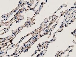 ANXA3 Mouse anti-Human, Clone: OTI2F3, lyophilized, TrueMAB 100 &mu;g;