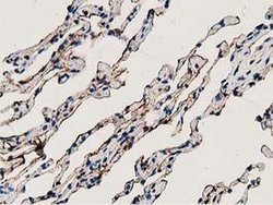 ANXA3 Monoclonal Antibody (OTI2F3), TrueMAB , OriGene 100 &mu;L; Unconjugated:Antibodies,