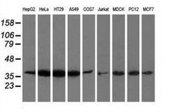 ANXA3 Monoclonal Antibody (OTI1A9), TrueMAB , OriGene 30 &mu;L; Unconjugated:Antibodies,