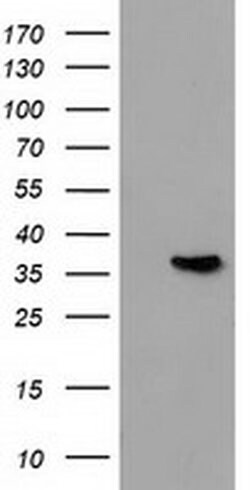 ANXA3 Monoclonal Antibody (OTI5G4), TrueMAB , OriGene 100 &mu;L; Unconjugated:Antibodies,
