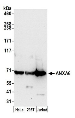 ANXA6 Polyclonal Antibody, Bethyl Laboratories 20 &mu;l; Unlabeled:Antibodies,