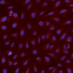 alpha Adaptin Monoclonal Antibody (AP6), Alexa Fluor 555, Invitrogen 50 &mu;g | Buy Online | Thermo Scientific | Fisher Scientific