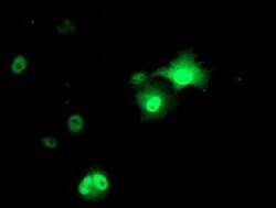 AP2M1 Mouse anti-Human, Clone: OTI1F10, lyophilized, TrueMAB 100 &mu;g;