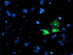 AP2M1 Monoclonal Antibody (OTI1E9), TrueMAB , OriGene 100 &mu;L; Unconjugated:Antibodies,