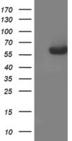 AP2M1 Mouse anti-Canine, Human, Mouse, Rat, Clone: OTI1C8, lyophilized,