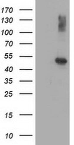 AP2M1 Mouse anti-Canine, Human, Rat, Clone: OTI 2F11, liquid, TrueMAB 100