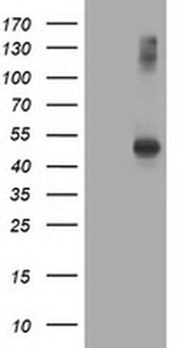 AP2M1 Monoclonal Antibody (OTI2D10), TrueMAB , OriGene:Antibodies:Primary