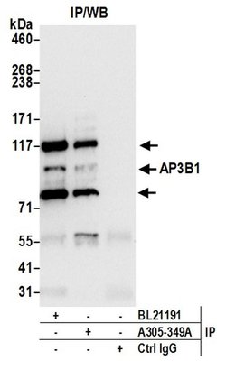AP3B1 Rabbit anti-Human, Polyclonal, Bethyl Laboratories 100 &mu;L; Unconjugated:Antibodies,
